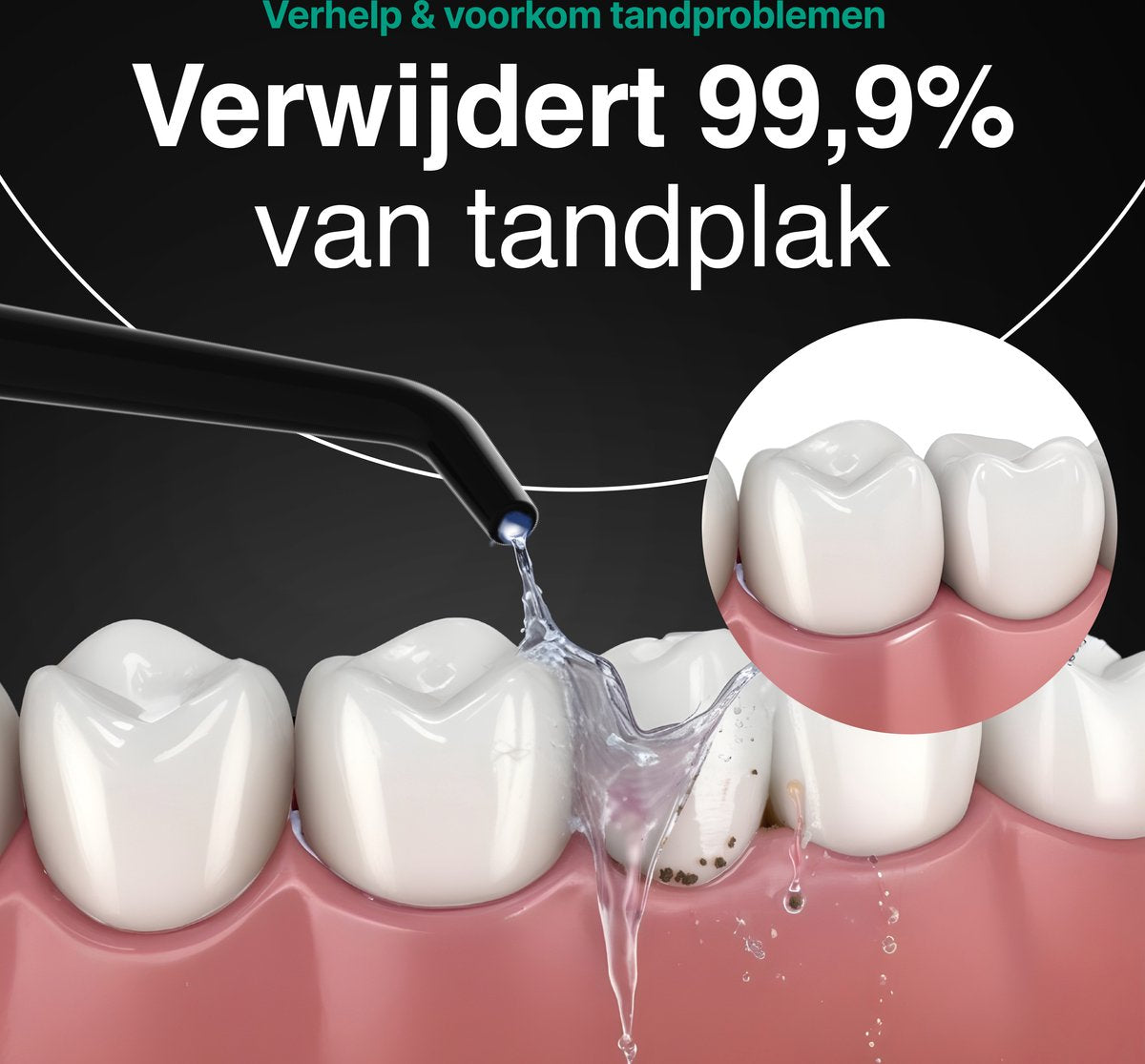 Waterflosser